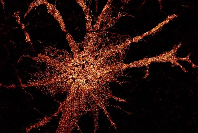 Endoplasmic reticulum stained in Astrocytes