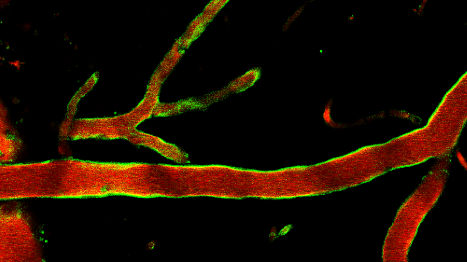 Blood brain barrier imagery