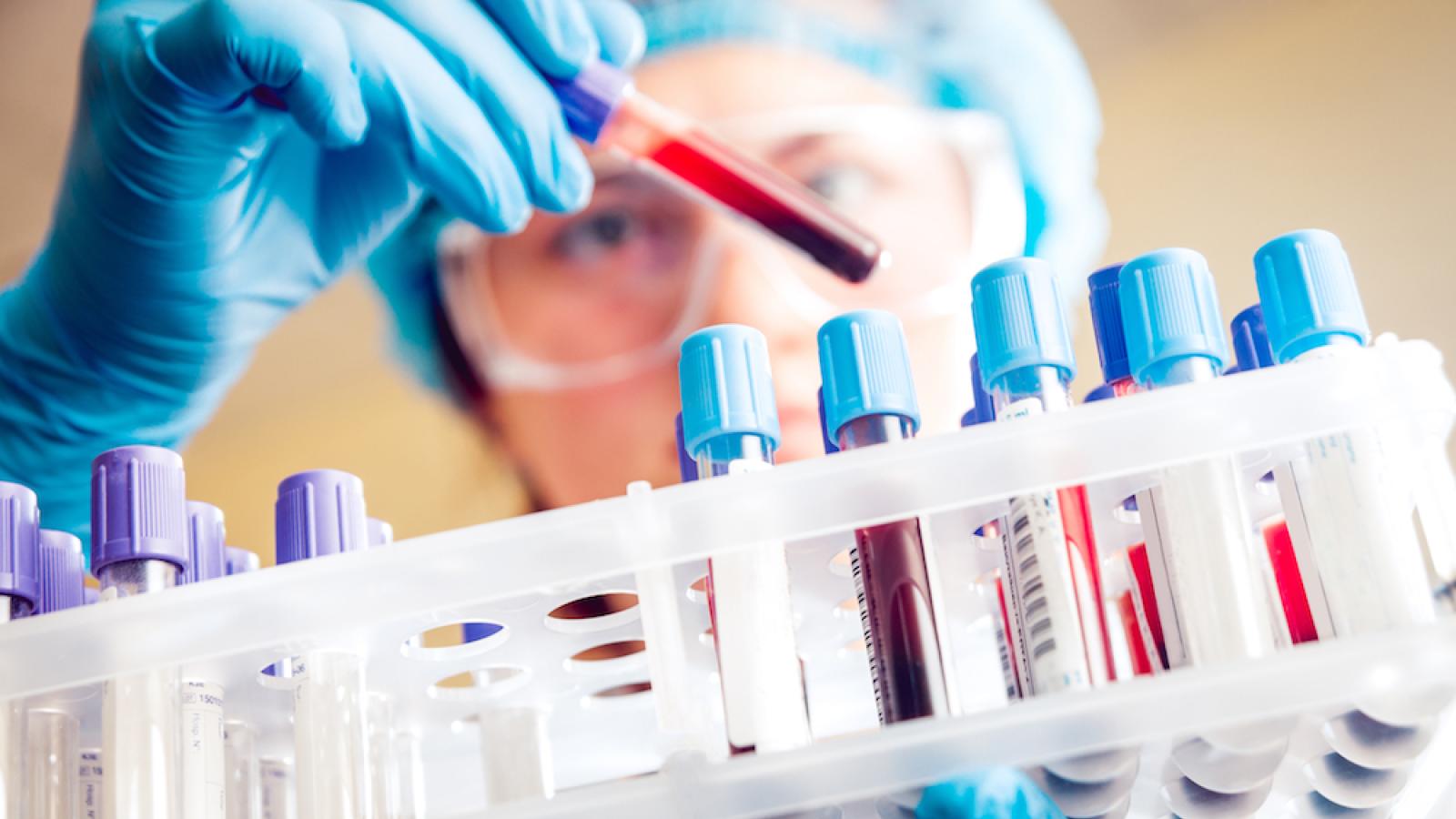 Blood test
