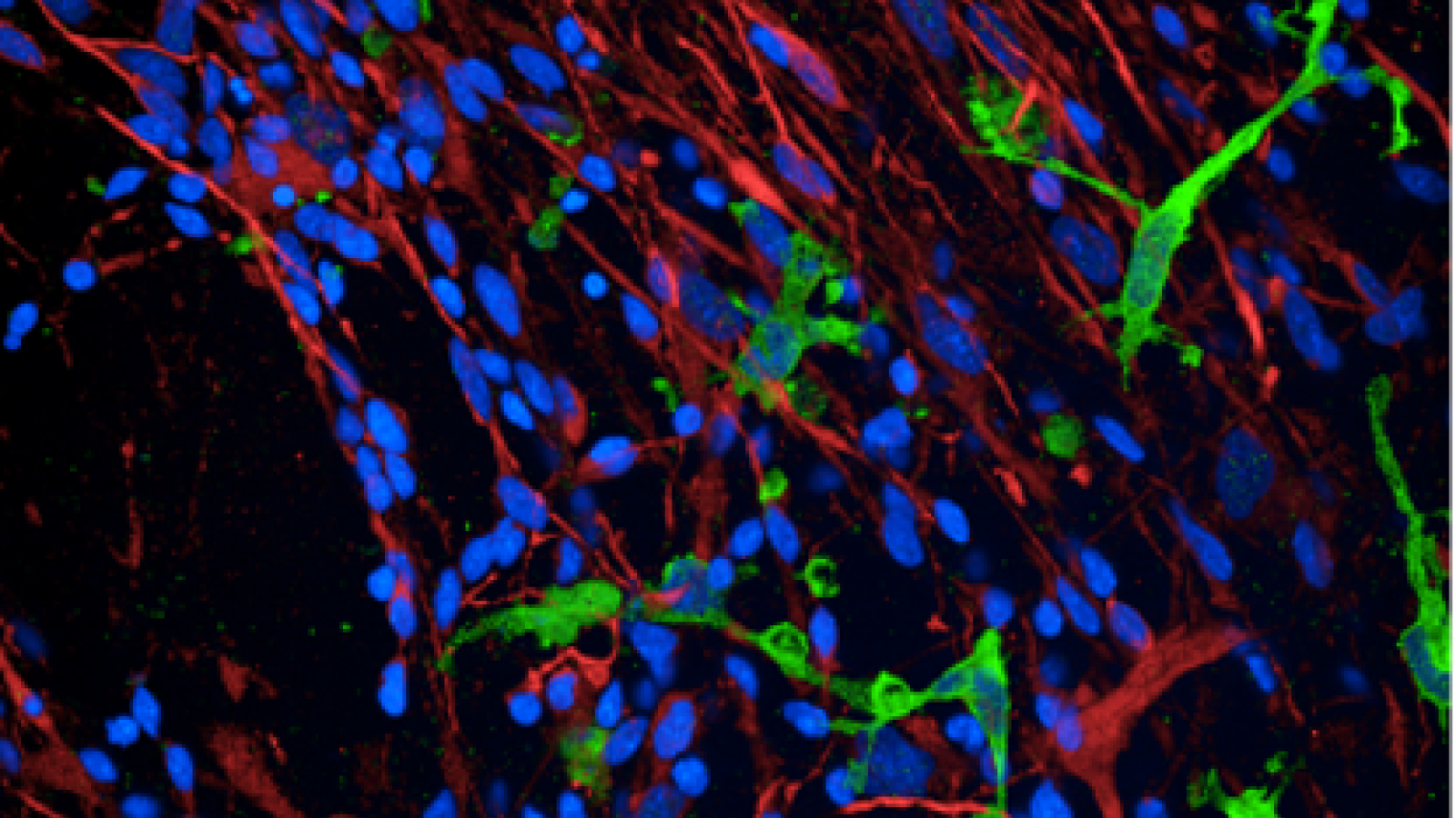 Neurons and microglia 