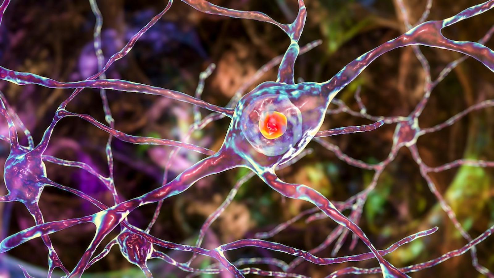 Illustration of huntingtin protein in neuron