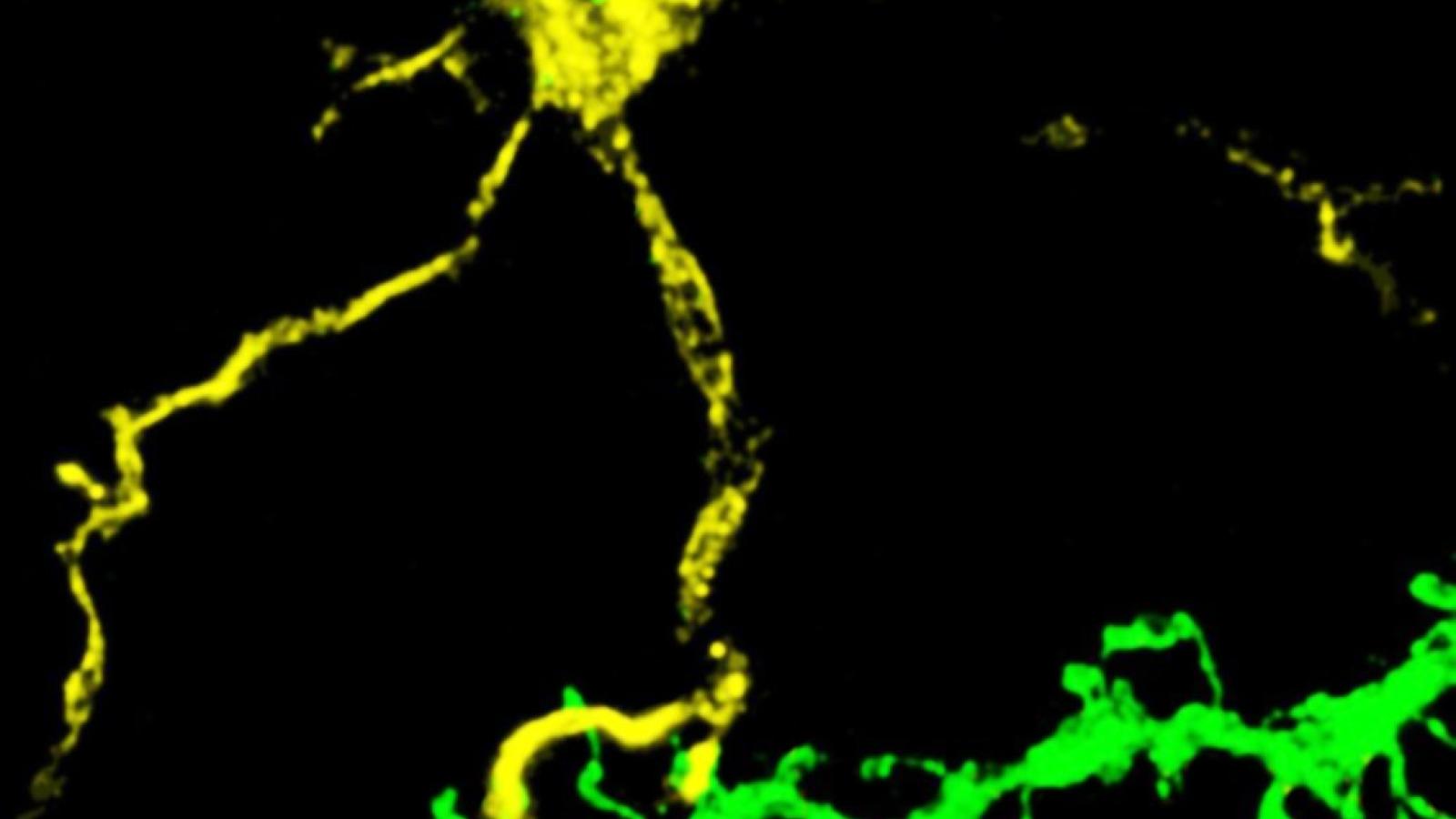 Confocal microscopy of a microglia interacting with dendritic spines