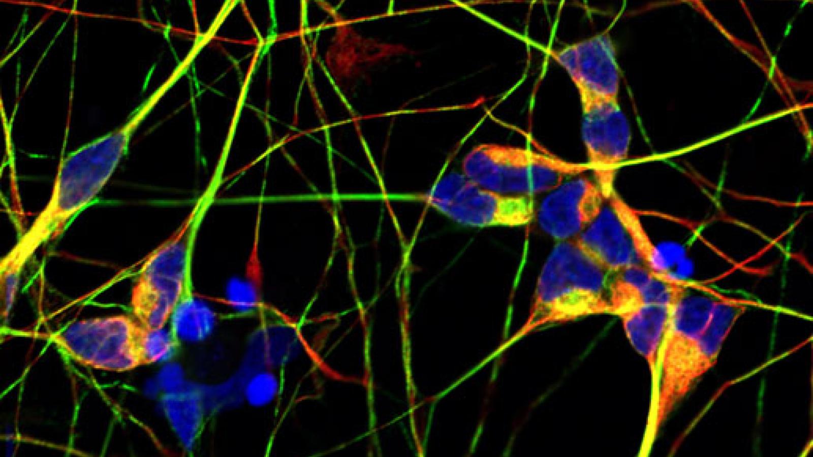 iPSC cells