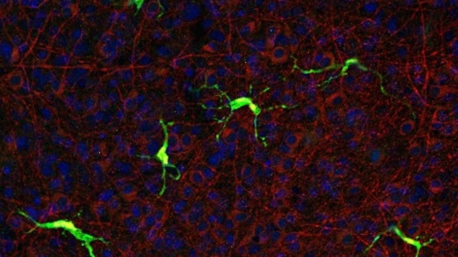 A fluorescence microscopy image of brain tissue showing green-labeled microglia with branching processes against a background of red and blue stained cellular structures.