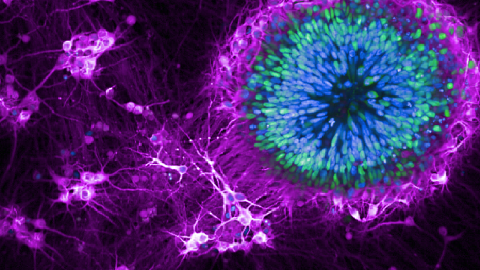 iPSC cells