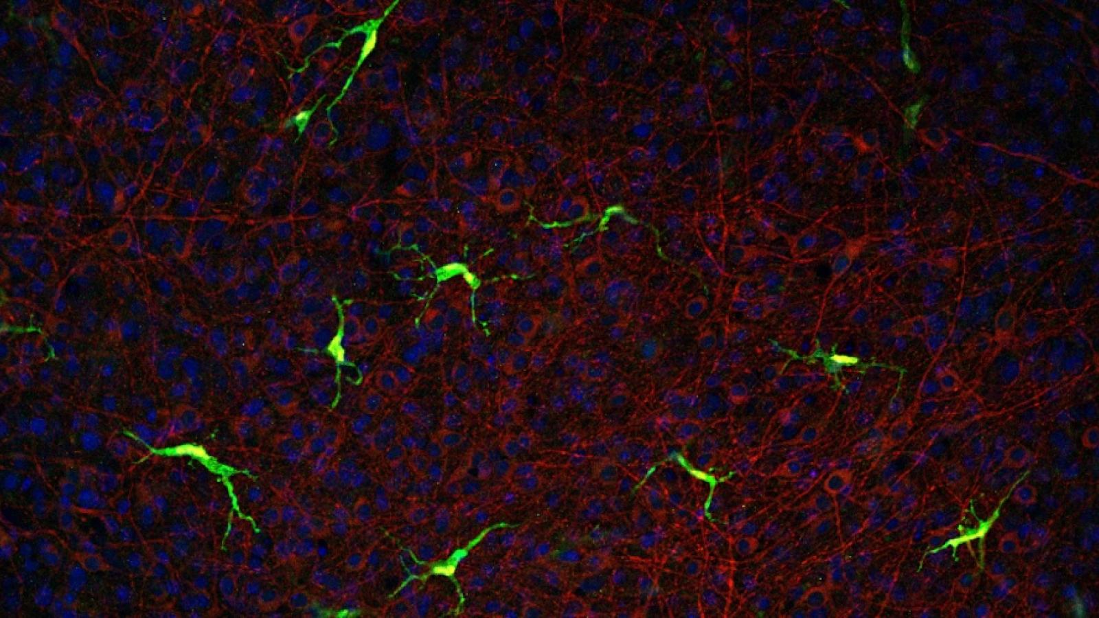 How cells called microglia (red and cyan) respond to problems in the brain