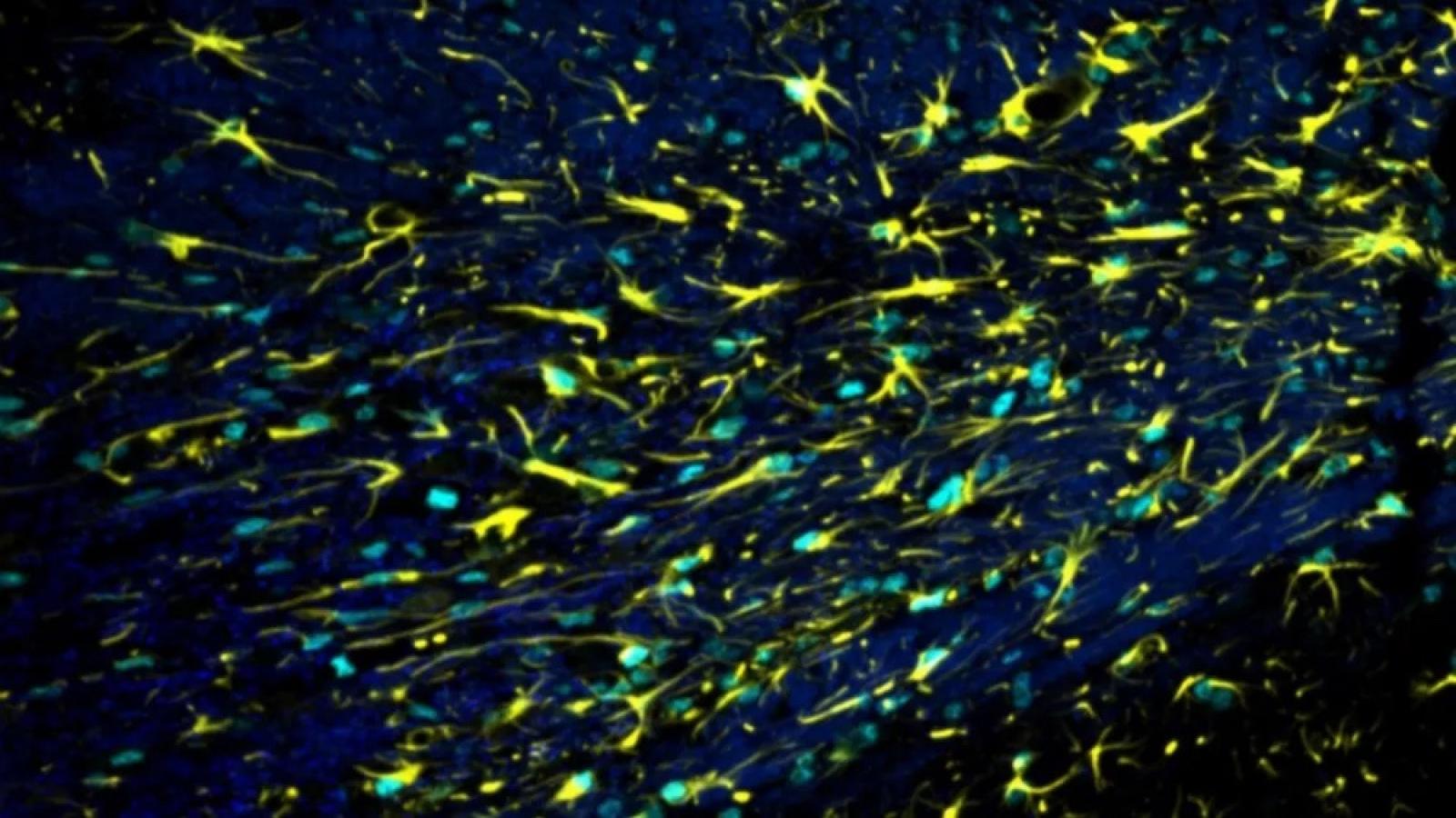 Astrocyte brain cells