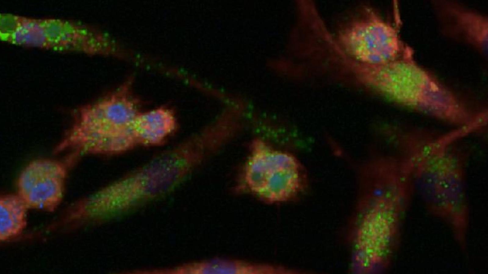 IPSC microglia engulfing amyloid protein