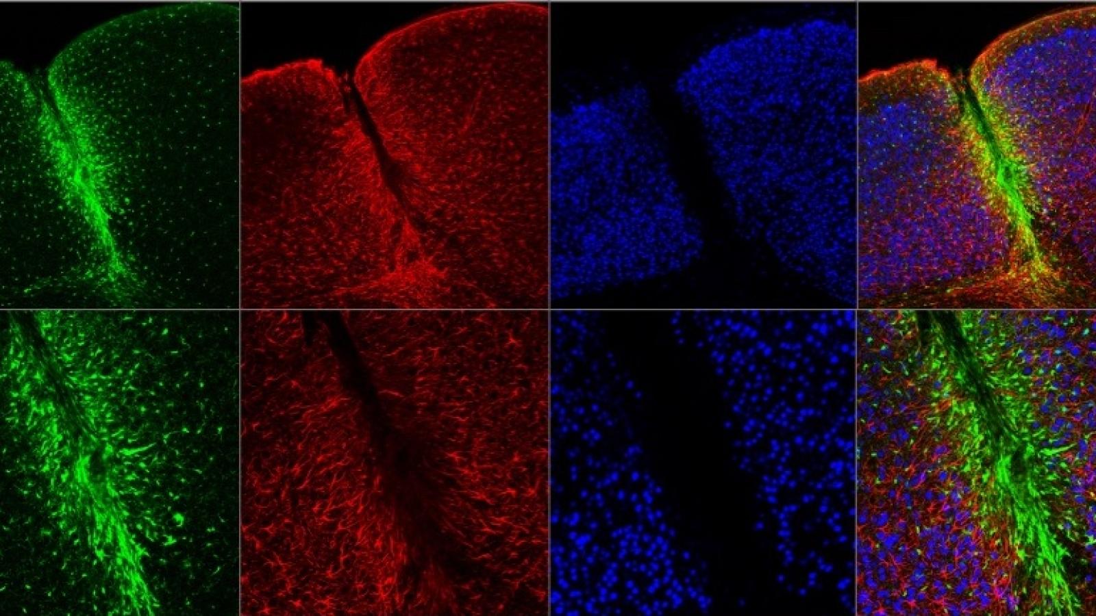TBI in mice