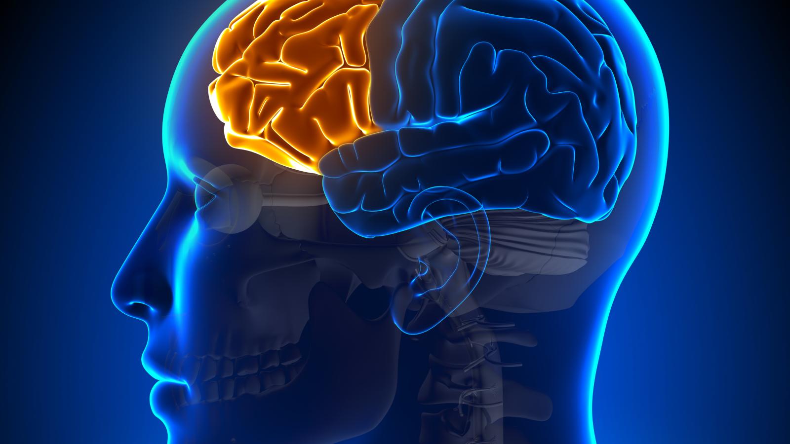 FTD brain image