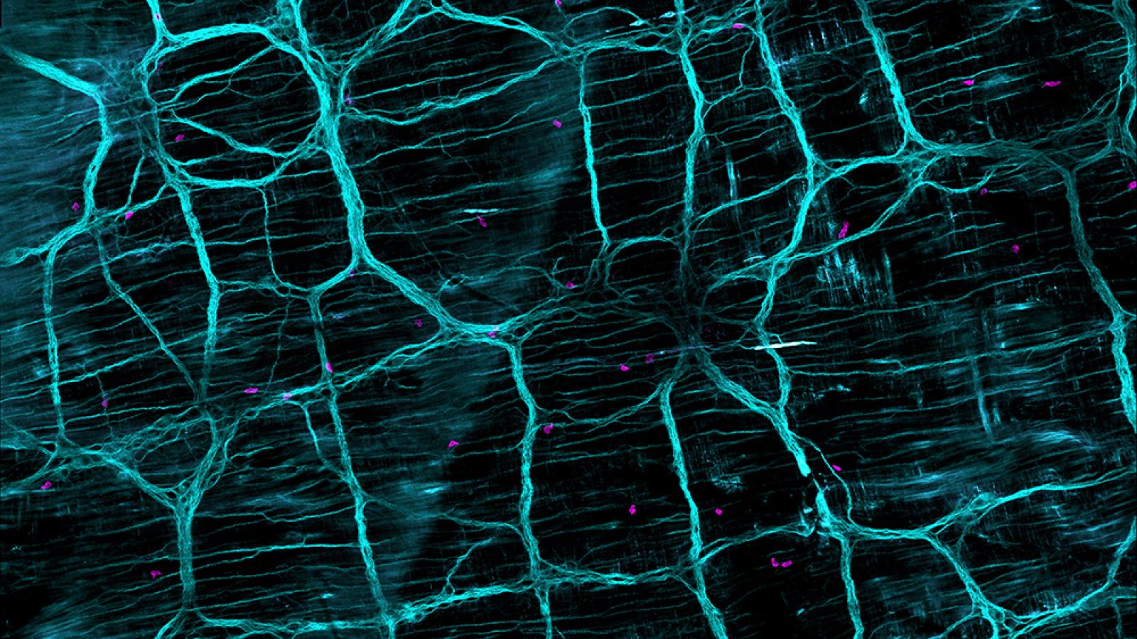 A neuronal network with t-cells and microglia highlighted