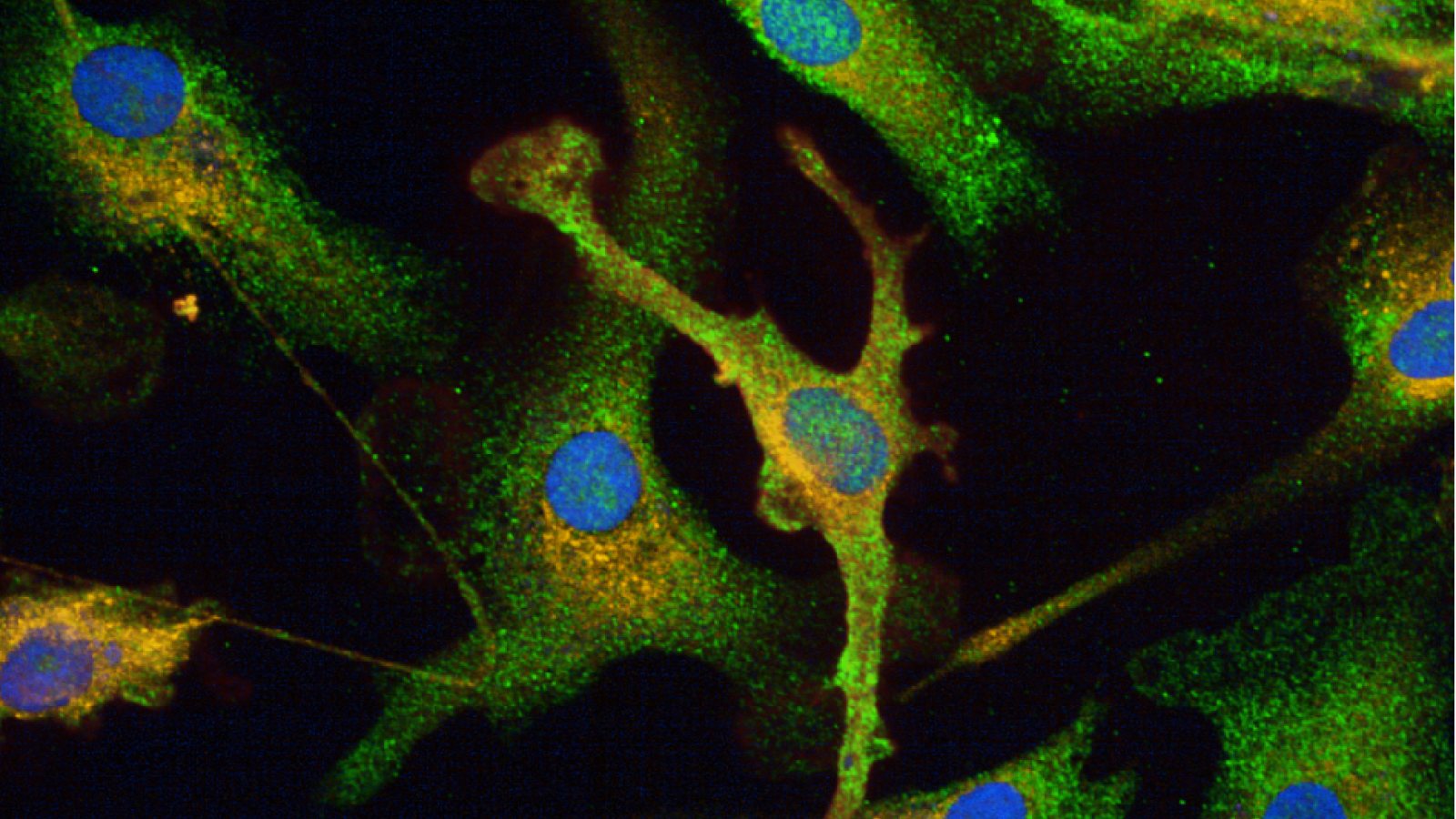 93rd Harden Conference: Endosomal-lysosomal network dysfunction in neurodegeneration