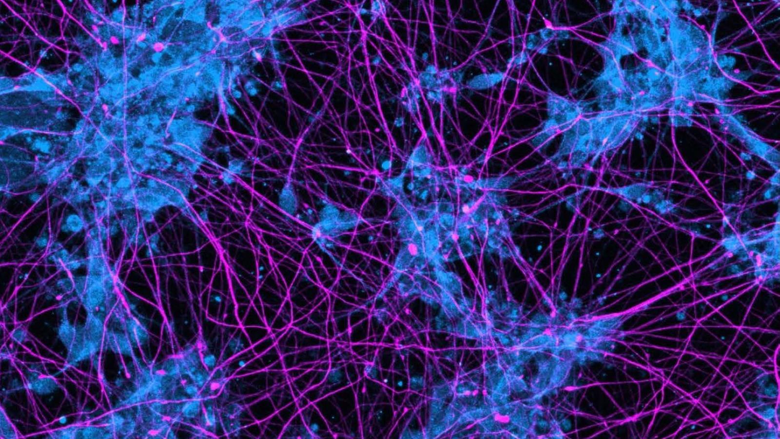 human iPSC-derived motor neurons showing axons in purple and neuronal cell bodies in blue