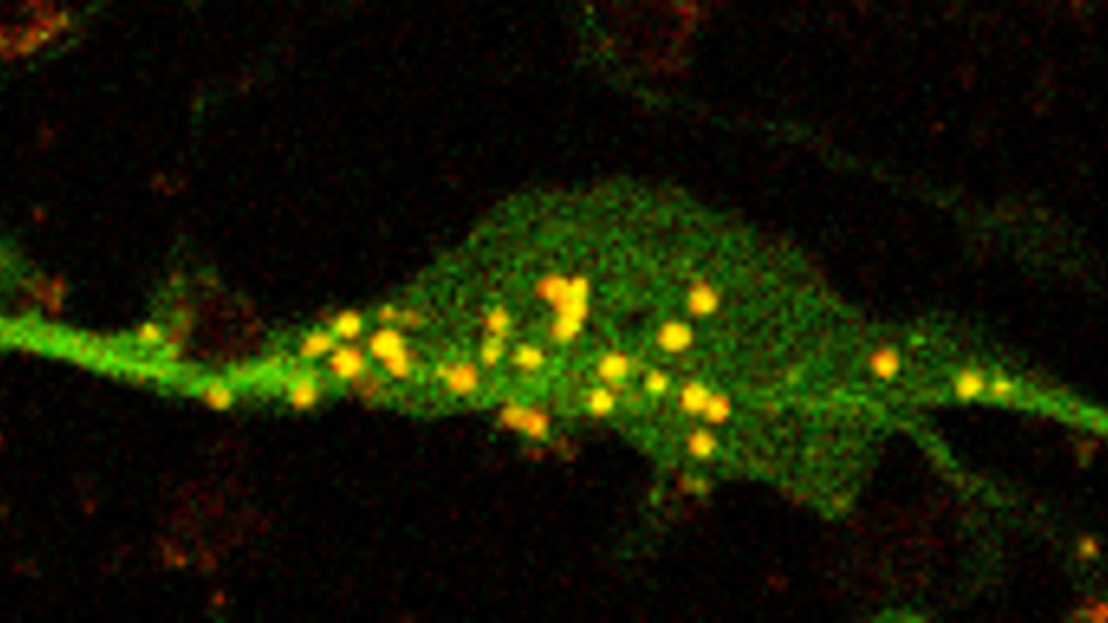 autophagosome in neuron