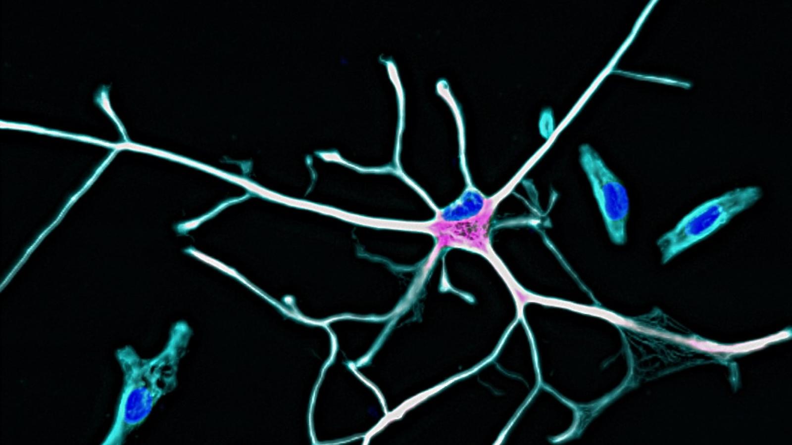 A human astrocyte in culture