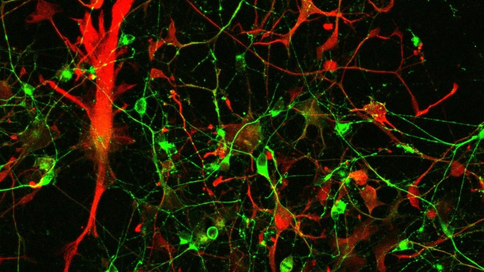 Astrocytes and motor neurons