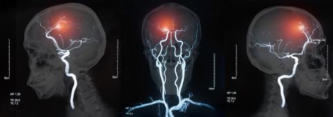 MRI stroke - shutterstock create jobs 51