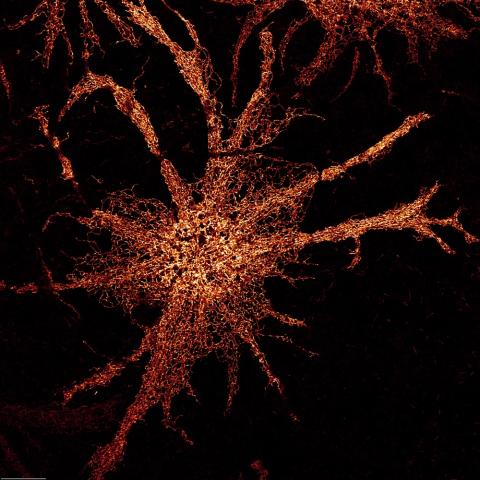 Endoplasmic reticulum stained in Astrocytes