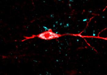Hippocampal neuron filled with tau
