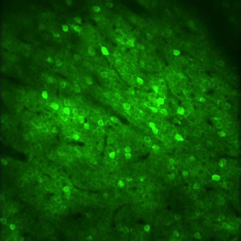 Neurons in the cerebral cortex