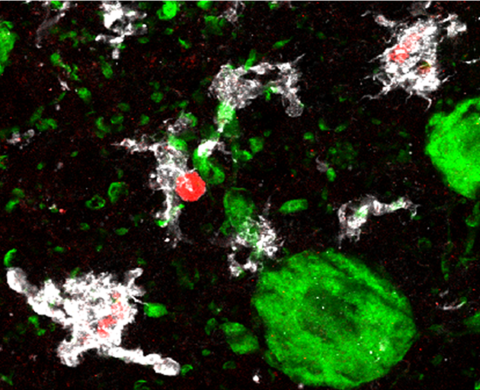 Immune cells in the substantia nigra of rats