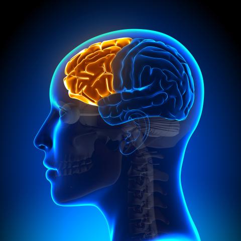 FTD brain image