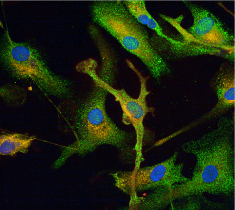 93rd Harden Conference: Endosomal-lysosomal network dysfunction in neurodegeneration