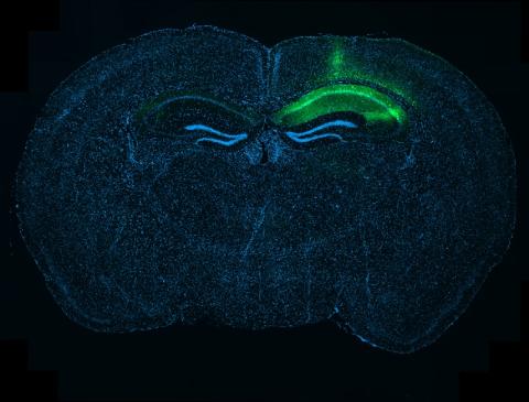 Whole-brain section showing local tau expression in the hippocampus