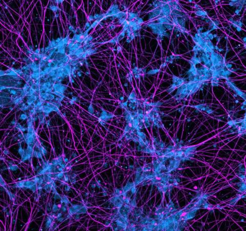 human iPSC-derived motor neurons showing axons in purple and neuronal cell bodies in blue