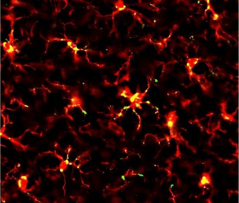 Microglia, the brain's immune cells after ultrasound treatment. Credit- Sarina Grewal, Morse Lab, Imperial College London.jpg