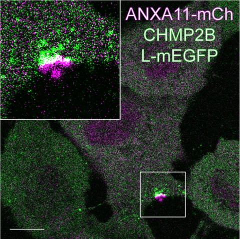 Sequential recruitment of ANXA11-mCh (magenta) and CHMP2B-L-mEGFP (green) to sites of plasma membrane damage