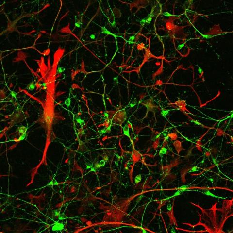 Astrocytes and motor neurons
