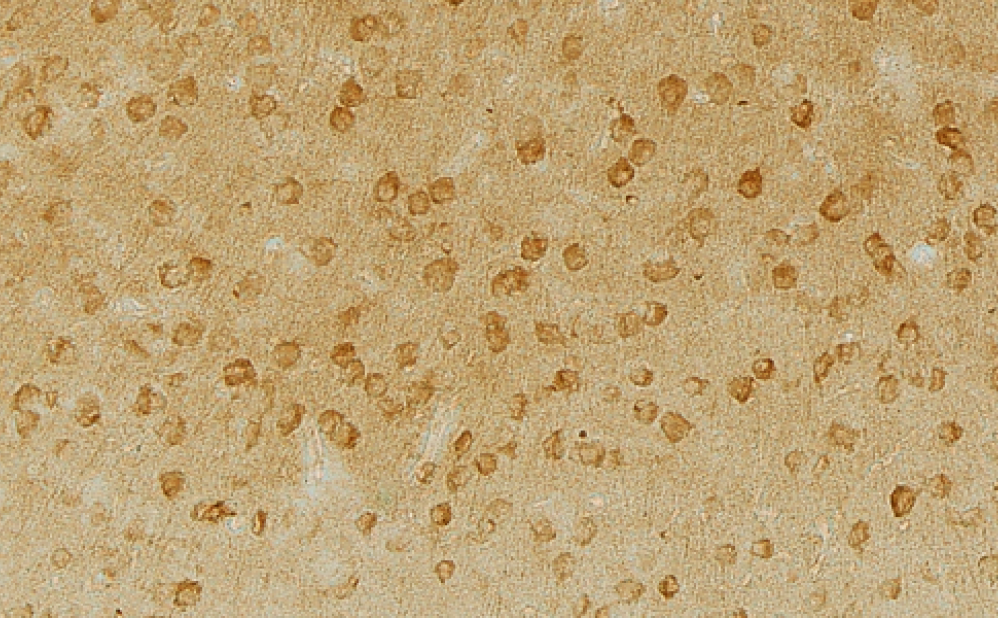 Phospho-tau accumulation in MAPT knockout mice