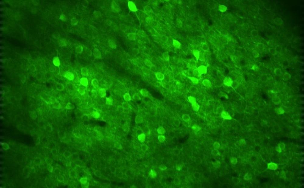 Neurons in the cerebral cortex