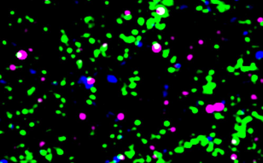 C1q and synapse image