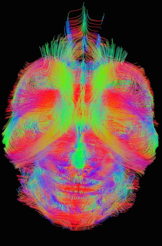 Diffusion imaging