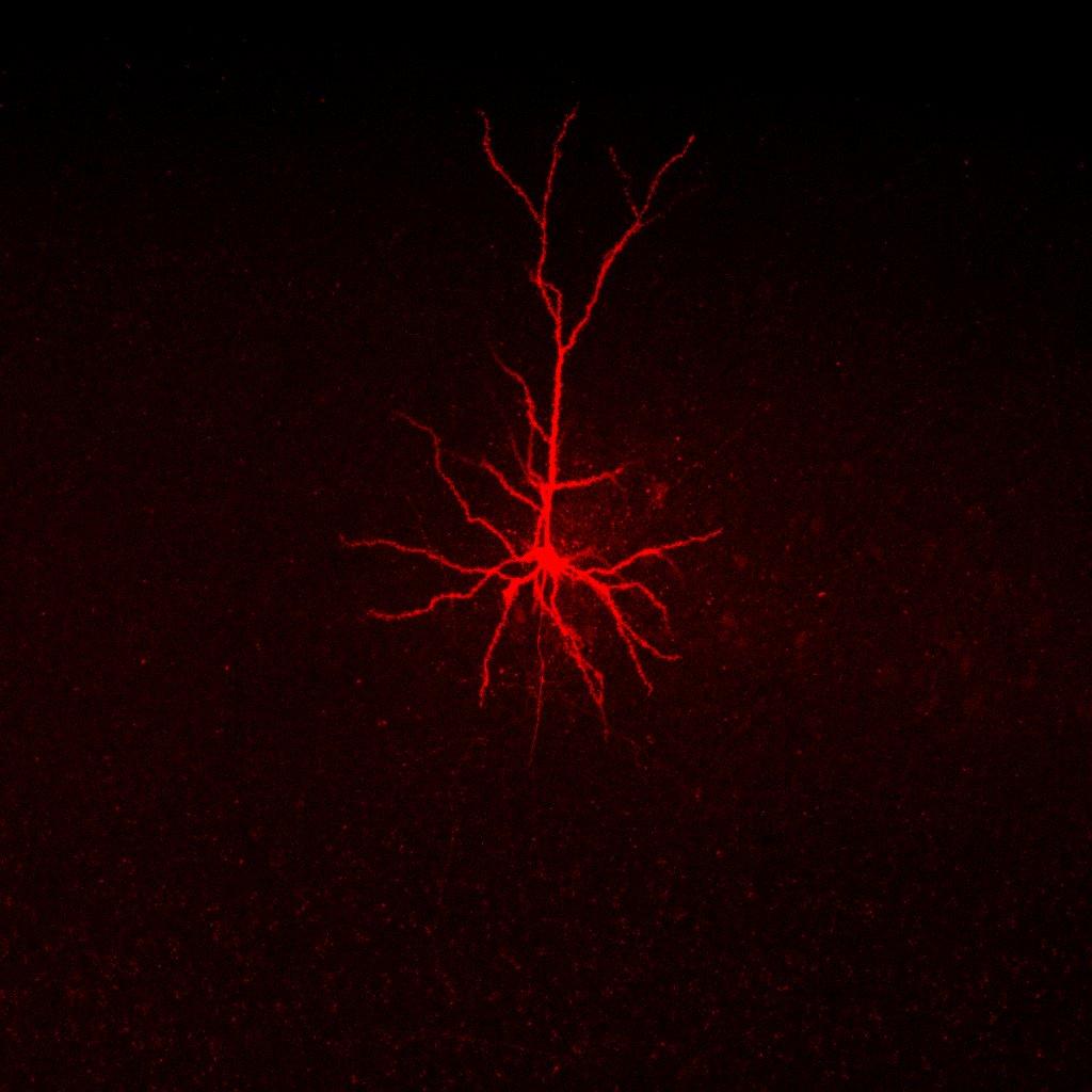 Barnes lab image of a pyramidal neuron