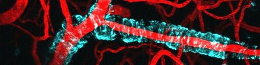 a blood vessel (in red) with amyloid-beta (in cyan) wrapped around it, in the brain of a mouse.