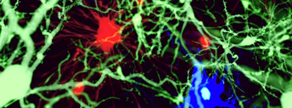 3-types-of-brain-cell_Juan_Gaertner_shutterstock.jpg#asset:5787